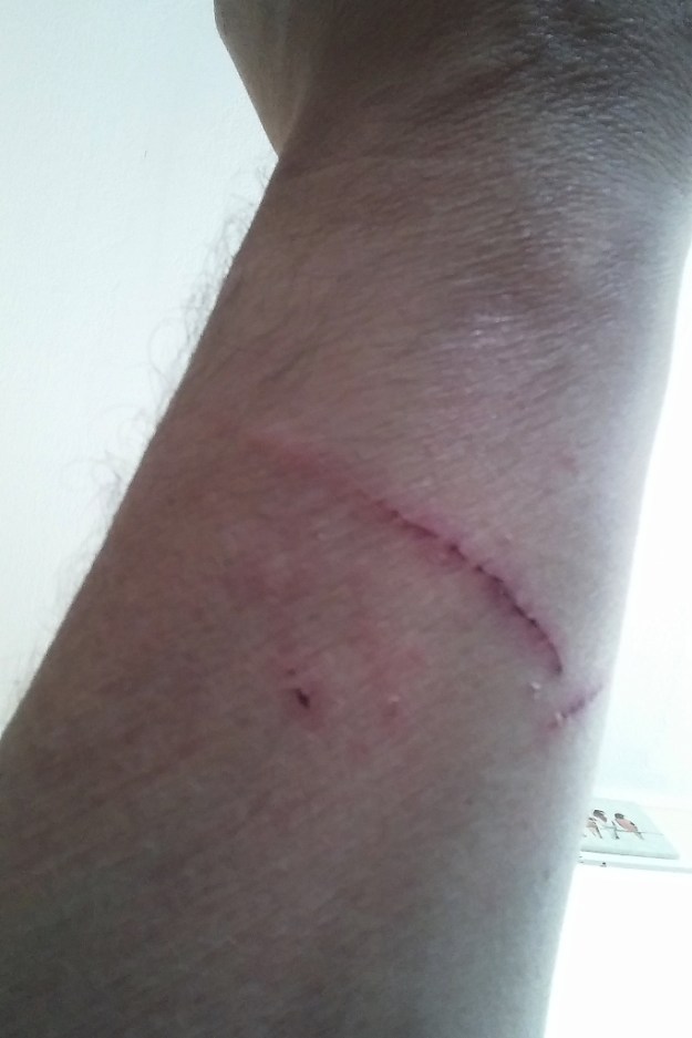 scratch from bad cat chris